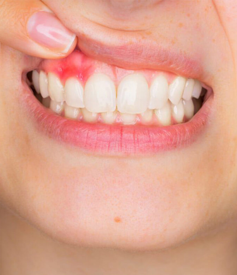 estetik diş-hekimliği