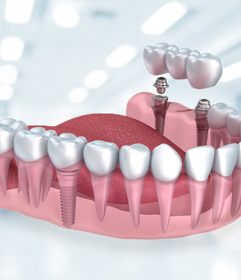 estetik diş-hekimliği